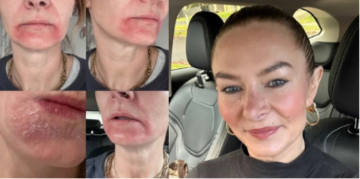 PrimalCare tallow balm skin transformation NZ