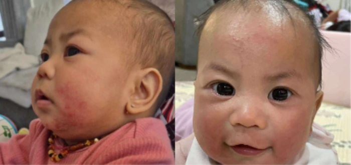 PrimalPantry tallow balm NZ before and after